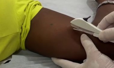 Floriano avança na oferta de DIU e Implanon e amplia acesso da população à política pública